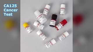CA125 ELISA-test voor kankermonitoring