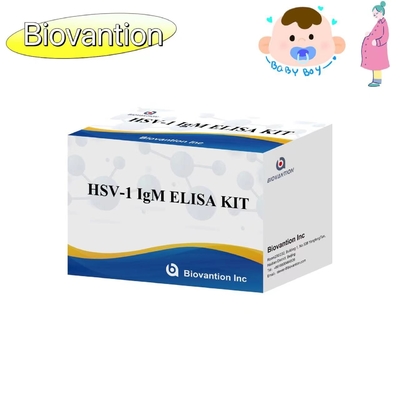 Torch ELISA Test Kit HSV 1 IgM High Hot Sale Diagnostisch Reagens IVD