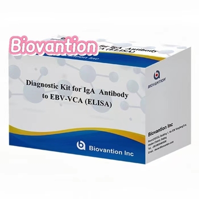 Hoge gevoeligheid EBV VCA IgA ELISA kit voor medische diagnose met behulp van 50 μl serummonster