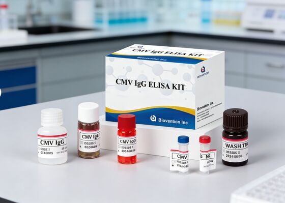 Laboratorium- of ziekenhuiskit met hoge nauwkeurigheid voor CMV IgG Elisa-test