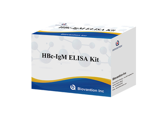 Van de Testkit hepatitis B van ISO13485 HBc IgM van het de Kernantilichaam de Test van Igm