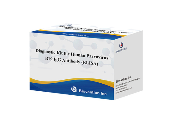 Diagnostische kit voor het menselijk parvovirus B19 IgG elisa test kit Antistof voor serummonsters