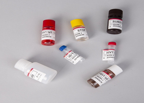 Voor laboratorium- of ziekenhuiskit met hoge nauwkeurigheid CA15-3 Elisa-testkit