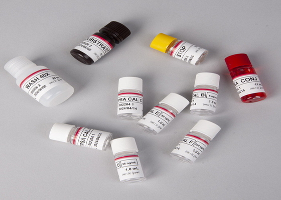 Laboratorium of ziekenhuis High Precision Antibody IgM To Cytomegalovirus (CMV) ELISA TEST KIT
