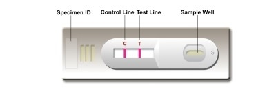 Laboratorium- of ziekenhuis-zelftest Hoge nauwkeurigheid Leishmania Ab Combo Rapid Test