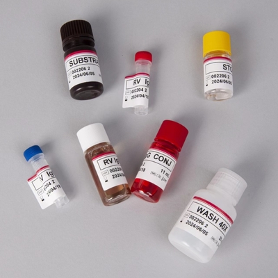 RV-G Elisa-testkit voor de diagnose van het plasma-monstertype