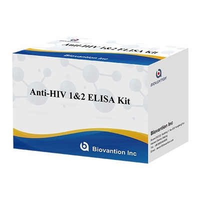HIV Elisa Test Kit 18 maanden houdbaarheid Elisa-test met hoge gevoeligheid en specificiteit