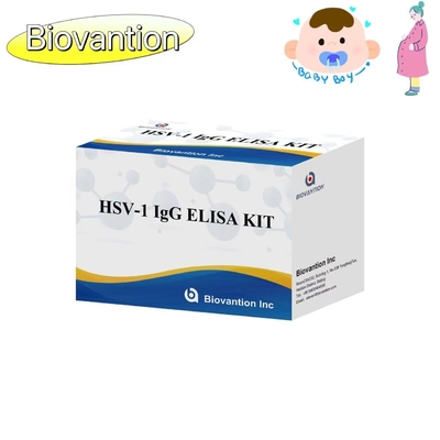 HSV 1 IgG Torch ELISA Test Kit High Hot Sale Diagnostisch reagens IVD