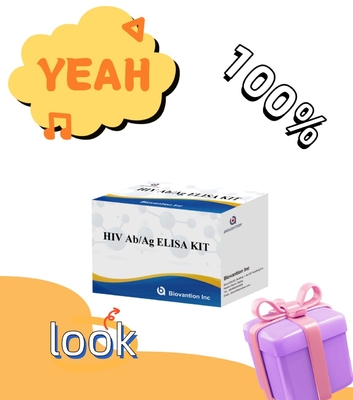 HIV Ab Ag Elisa-testkits met een houdbaarheid van 18 maanden en een hoge gevoeligheid/specificiteit