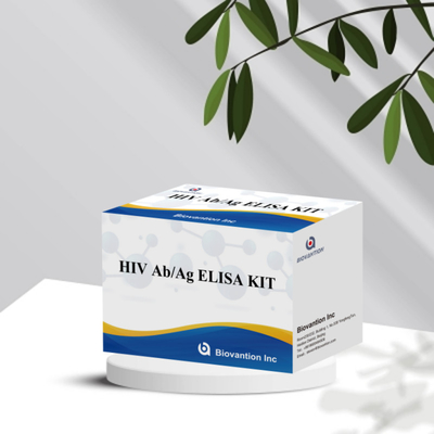 HIV Ab Ag Elisa-testkits met een houdbaarheid van 18 maanden en een hoge gevoeligheid/specificiteit