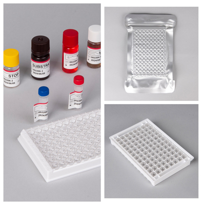 HIV Ab Ag Elisa-testkits met een houdbaarheid van 18 maanden en een hoge gevoeligheid/specificiteit