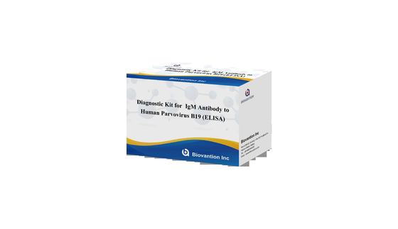 Diagnostische kit voor het menselijk parvovirus B19 IgG elisa test kit Antistof voor serummonsters