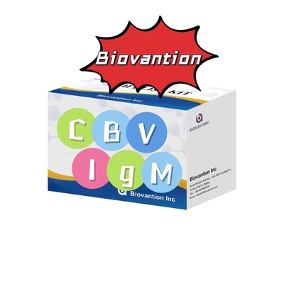 Diagnostische kit voor IgM-antilichaam tegen CBV Elisa Test Kit 50μL Serum Medische diagnose