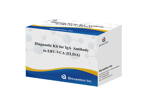 Hoge gevoeligheid EBV VCA IgA ELISA kit voor medische diagnose met behulp van 50 μl serummonster