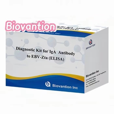 Diagnostische kit voor IgA-antilichaam tegen EBV-Zta ELISA-test kit Immunosorptieve assay test kit