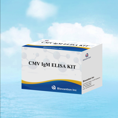 Macrophage IgM kwalitatieve ELISA-test IVD Experimentele kit
