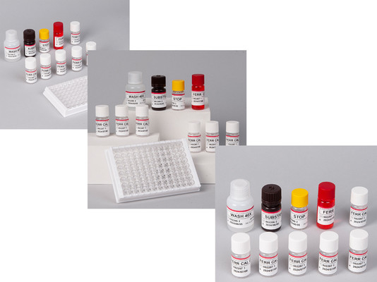 Laboratorium of ziekenhuis Hoge precisie Human ferritine FE ELISA TEST KIT