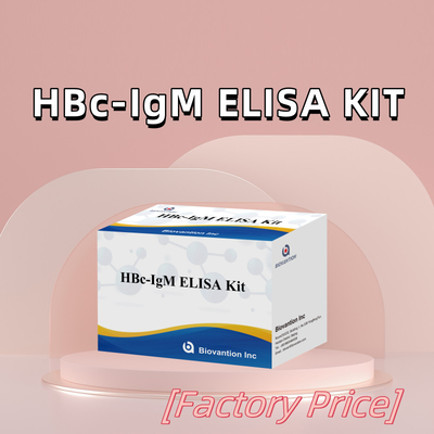 Hoge nauwkeurigheid HBc IgM Anthgen Diagnostisch Reagent Test Met Enzym-Linked Immunosorbent Assay Test Kit