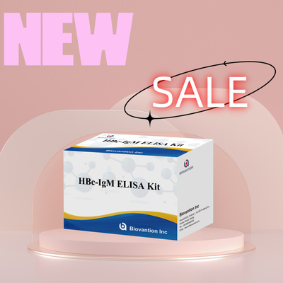 Hoge nauwkeurigheid HBc IgM Anthgen Diagnostisch Reagent Test Met Enzym-Linked Immunosorbent Assay Test Kit