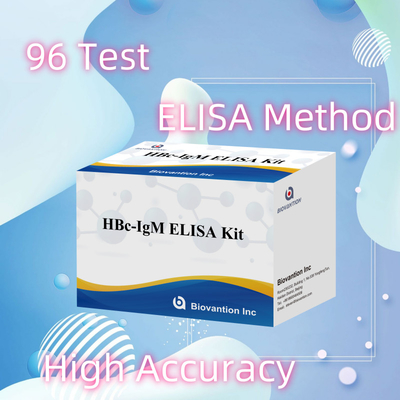 Hoge nauwkeurigheid HBc IgM Anthgen Diagnostisch Reagent Test Met Enzym-Linked Immunosorbent Assay Test Kit