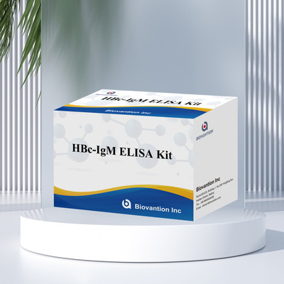Hoge nauwkeurigheid HBc IgM Anthgen Diagnostisch Reagent Test Met Enzym-Linked Immunosorbent Assay Test Kit