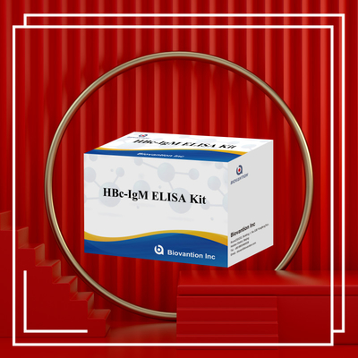 Hoge nauwkeurigheid HBc IgM Anthgen Diagnostisch Reagent Test Met Enzym-Linked Immunosorbent Assay Test Kit