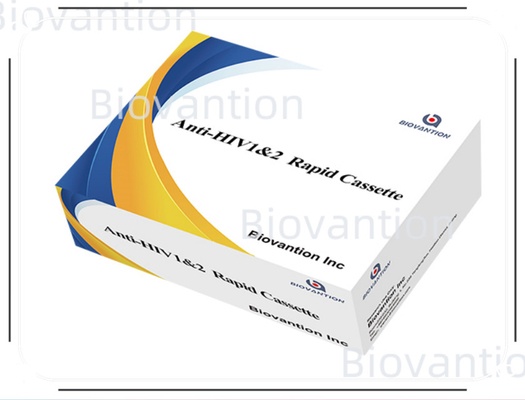 Rapid test reagens HIV 1/2 Detectie test met colloïdaal goud methode met 25 tests