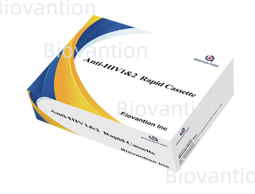 Rapid test reagens HIV 1/2 Detectie test met colloïdaal goud methode met 25 tests