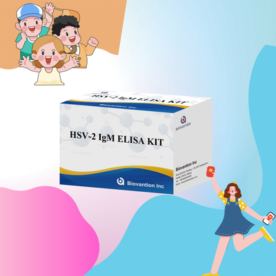 Hoge specificiteit Elisa Test Kit HSV-2 IgM voor snelle en nauwkeurige resultaten medisch reagens voor menselijk gebruik