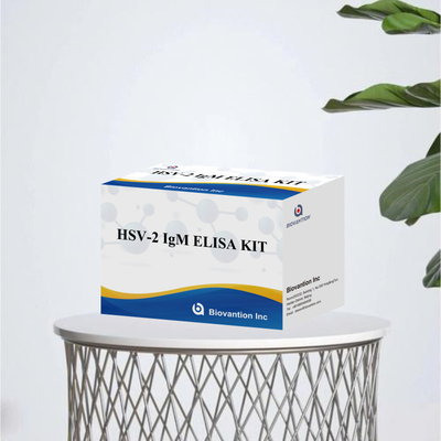 Hoge specificiteit Elisa Test Kit HSV-2 IgM voor snelle en nauwkeurige resultaten medisch reagens voor menselijk gebruik