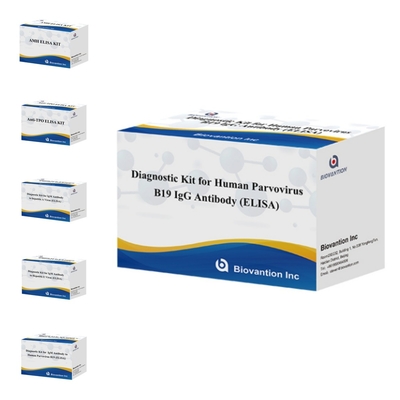 Fabriek rechtstreeks verkoop B19 ELISA Kit voor menselijk parvovirus B19 IgM antilichaam Elisa Test Kit met 96T