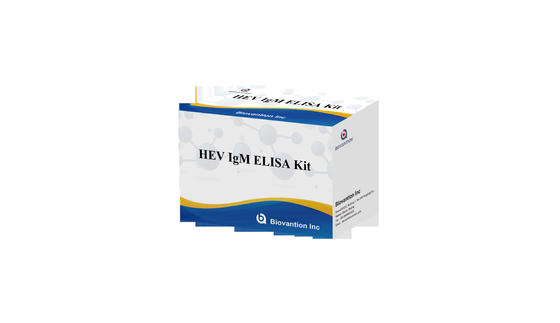 Laboratorium- of ziekenhuisantilichaam IgG tegen hepatitis E Virus HEV Elisa Test Kit