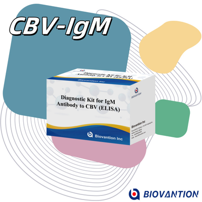 CBV igm ELISA KIT D diagnostisch reagens 18 maanden houdbaarheidsduur Enzymgebonden immunosorptieve test