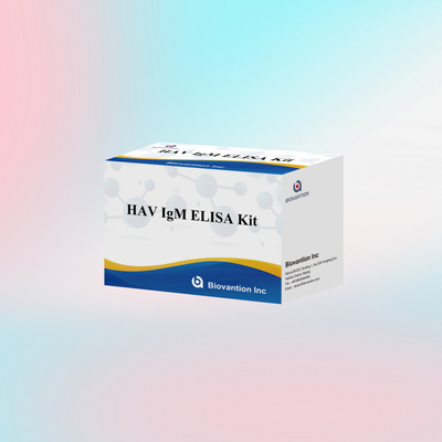 HAV IgM ELISA Kit Hoge gevoeligheid Hepatitis A Virusdetectie Betrouwbare nauwkeurige diagnostische test voor klinische laboratoria