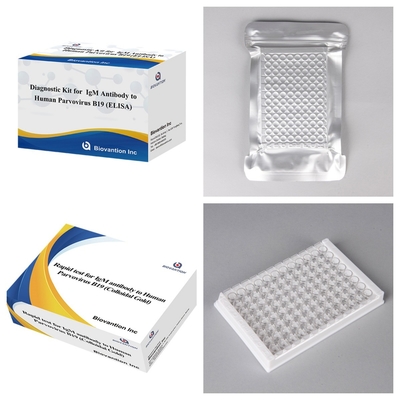 Advanced Human Parvovirus B19 IgM-antilichaam ELISA-testkit voor de opsporing en screening van zwangerschap
