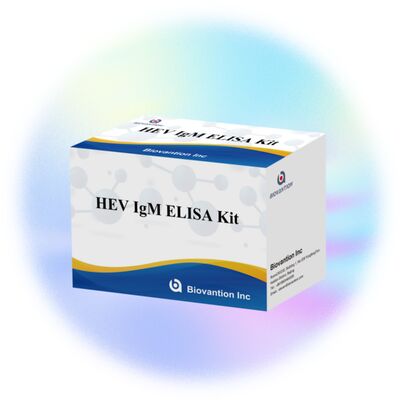 Hoge gevoeligheid HEV IgM Elisa Test Kit met 96T grootte en 2-3 uur testtijd voor een nauwkeurige diagnose