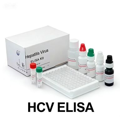 Anti-HCV-antilichamen tegen het hepatitis C-virus Enzymgebonden transporttijd Kort