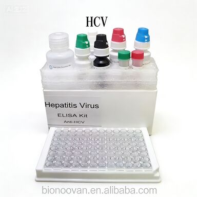 Anti-HCV-antilichamen tegen het hepatitis C-virus Enzymgebonden transporttijd Kort