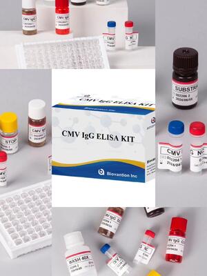 Laboratorium- of ziekenhuiskit met hoge nauwkeurigheid voor CMV IgG Elisa-test