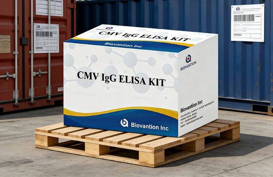 Laboratorium- of ziekenhuiskit met hoge nauwkeurigheid voor CMV IgG Elisa-test