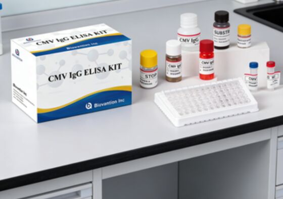 Laboratorium- of ziekenhuiskit met hoge nauwkeurigheid voor CMV IgG Elisa-test