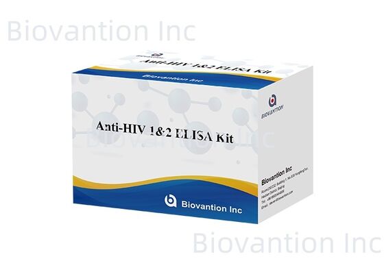 HIV 1/2 ELISA Testkit 96T Detectie van antistoffen tegen humaan immunodeficiëntievirus